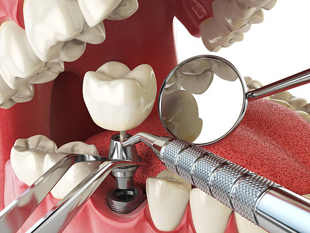 Best Emergency Orthodontic Repairs in Koontz Lake, IN